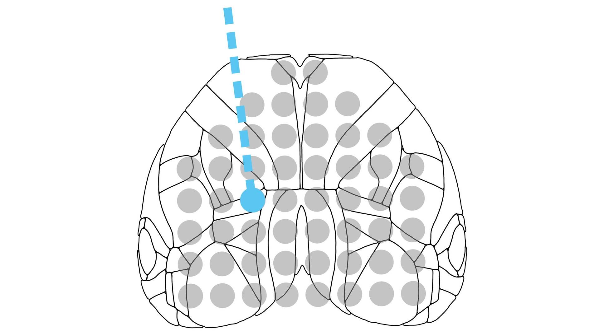 Optogenetics