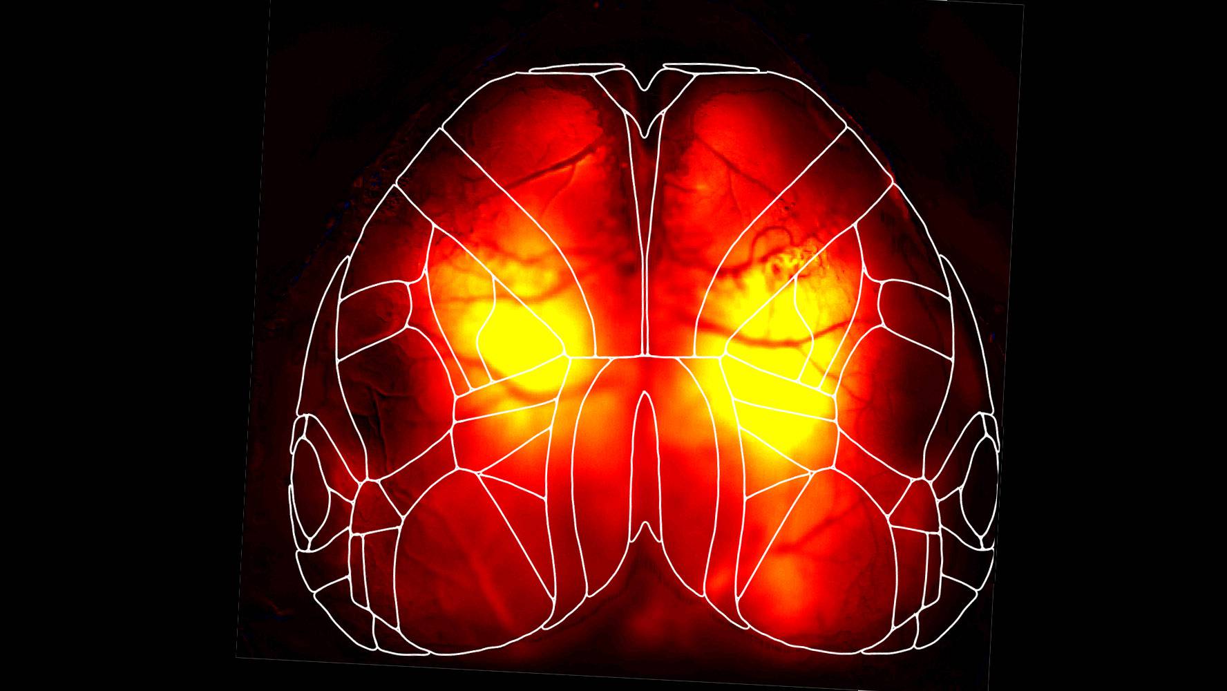 Widefield calcium imaging